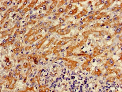 Polyclonal Rabbit anti-Human ATP5D Antibody (aa23-168)
