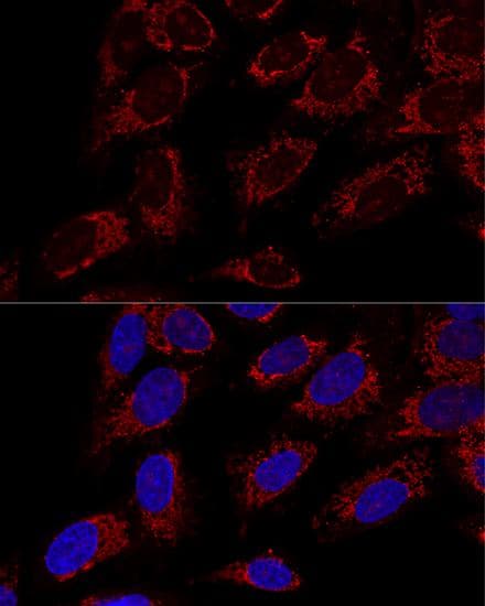 Polyclonal Rabbit anti-Human TOMM20 Antibody (IHC, IF)