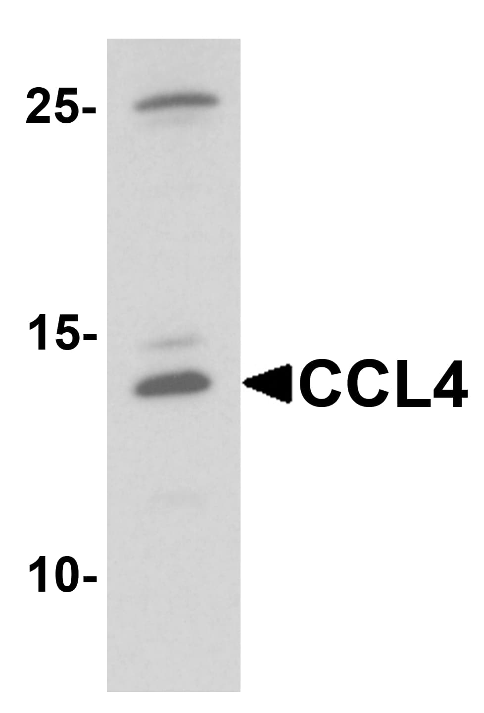 IHC-plus™ CCL4 / MIP-1 Beta Antibody