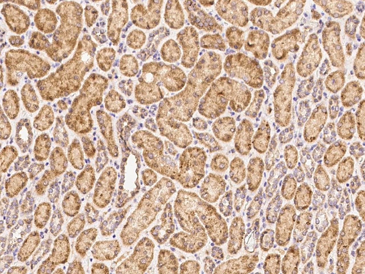 PTPN2 / TC-PTP Antibody (Preservative Free)