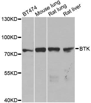 BTK Antibody