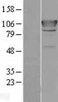 AARS Protein (Over-Expression Lysate Myc-DDK (Flag))