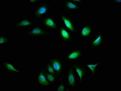 ATXN7 / SCA7 / Ataxin-7 Antibody