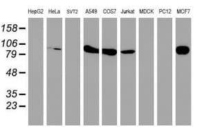 PFKP Antibody (clone OTI2E10)