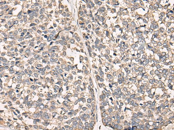 C12orf40 Antibody
