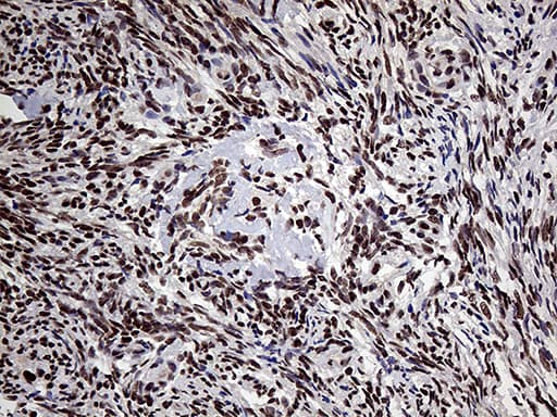 PPP4C Antibody (clone OTI2E4)