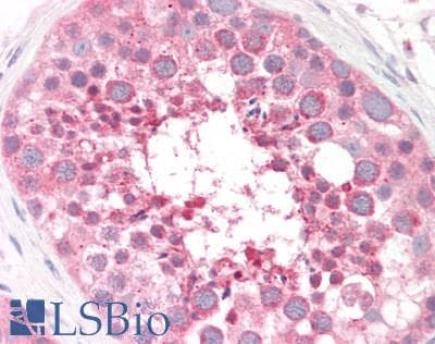 IHC-plus™ ARSA / Arylsulfatase A Antibody (aa431-442)