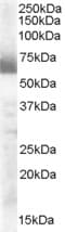 IHC-plus™ CYP17 / CYP17A1 Antibody (aa134-144)