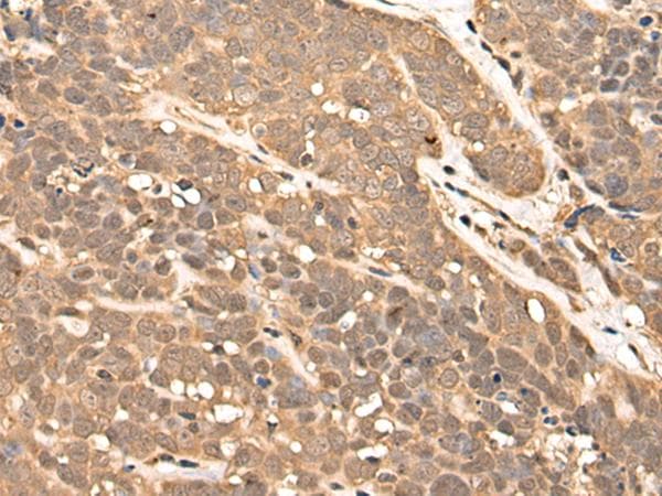 ZPR1 / ZNF259 Antibody