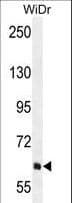 PIK3R5 Antibody (aa763-792)