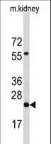 PEMT Antibody (aa1-30)