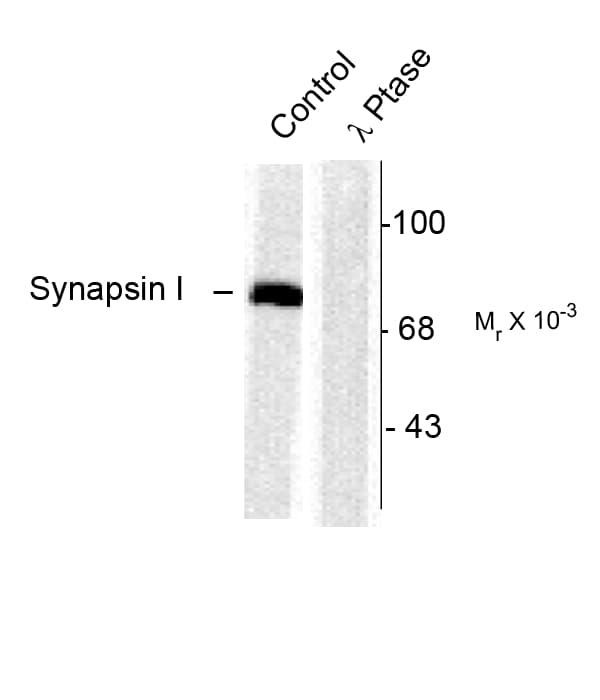 SYN1 / Synapsin 1 Antibody (phospho-Ser603)
