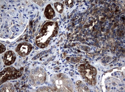NME1 / NM23 Antibody (clone UMAB91)