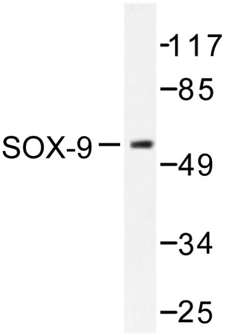 SOX9 Antibody (Gln175)