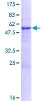 Human CUTC Protein (Recombinant GST)