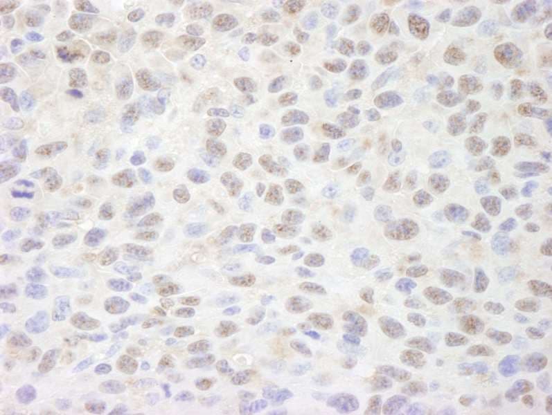 Polyclonal Rabbit anti-Human SIN3A Antibody (aa1-50, IHC)
