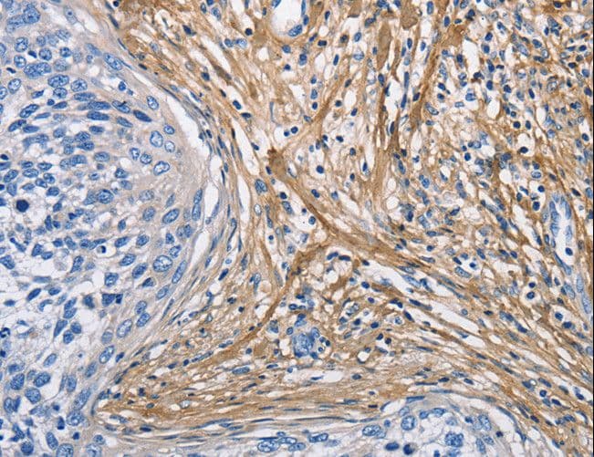 PathPlus™ COL3A1 / Collagen III Antibody