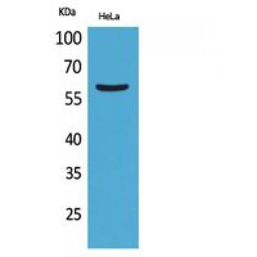 FMO3 Antibody (91-140 aa, Internal)