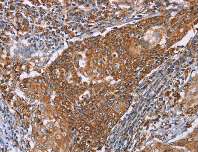 PMPCB / MPP11 Antibody