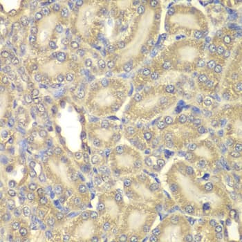 Polyclonal Rabbit anti-Human MBP / Myelin Basic Protein Antibody (IHC, IF, WB)