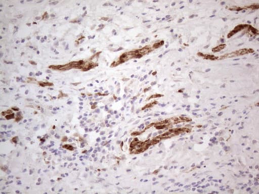 Monoclonal Mouse anti-Human ASPA Antibody (clone OTI3G5, aa77-313, IHC, WB)