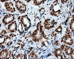 TLDC1 / KIAA1609 Antibody (clone OTI12B1)