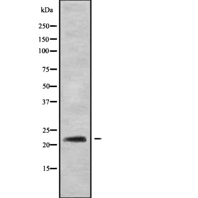 Polyclonal Rabbit anti-Human RAB22A / RAB22 Antibody (IHC, WB)