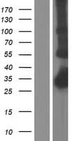 C1QTNF5 / CTRP5 Protein (Over-Expression Lysate Myc-DDK (Flag))