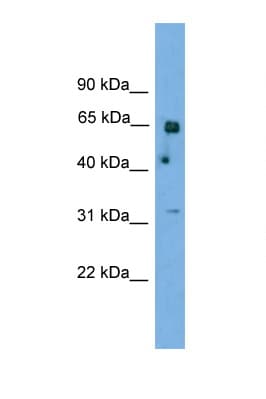 Polyclonal Rabbit anti-Human PNKP Antibody (N-Terminus, WB)