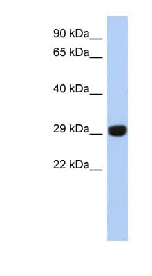 FN3KL / FN3KRP Antibody (N-Terminus)