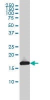 Monoclonal Mouse anti-Human UBE2L3 / UBCH7 Antibody (clone 3B7, IF, WB)