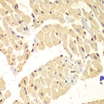 Polyclonal Rabbit anti-Human HIF1AN Antibody (IHC, IF, WB)