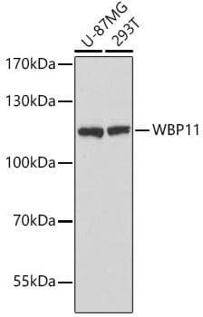 Polyclonal Rabbit anti-Human WBP11 Antibody (WB)