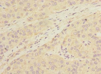 LHPP Antibody