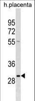 RAB22A / RAB22 Antibody (aa166-192)