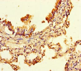 UBXN2B Antibody