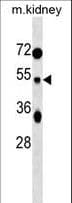 Polyclonal Rabbit anti-Human TUFT1 Antibody (aa276-304, WB)