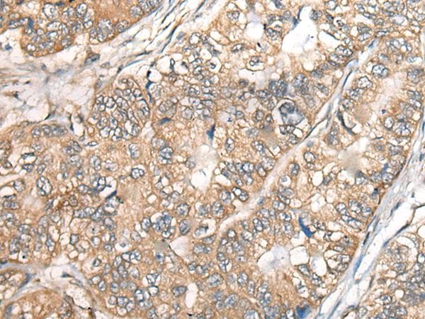 Polyclonal Rabbit anti-Human BCHE / Cholinesterase Antibody (IHC)