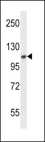 FGFR2 / FGF Receptor 2 Antibody (aa22-51)