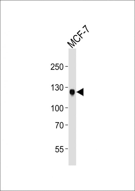 NEP / DDR1 Antibody (clone 1464CT339.1.54)