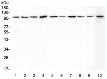 Polyclonal Rabbit anti-Human PLG / Plasmin / Plasminogen Antibody (WB)
