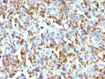 F13A1 / Factor XIIIa Antibody (clone F13A1/1683)