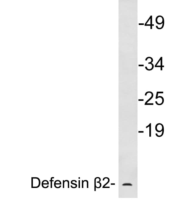 Polyclonal Rabbit anti-Human DEFB4A / BD-2 Antibody (aa41-90, WB)
