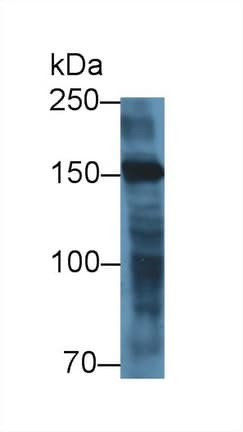 MYOM2 / Myomesin 2 Antibody (aa1130-1434, APC)