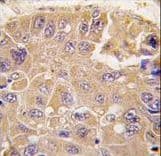 METAP2 Antibody (aa437-467)