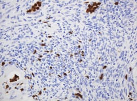 Monoclonal Mouse anti-Human CNKSR3 Antibody (clone OTI1D7, IHC, WB)