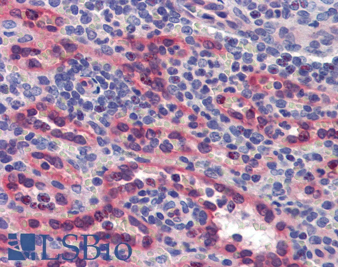 IHC-plus™ Polyclonal Rabbit anti-Human AKIRIN1 Antibody (IHC, WB)