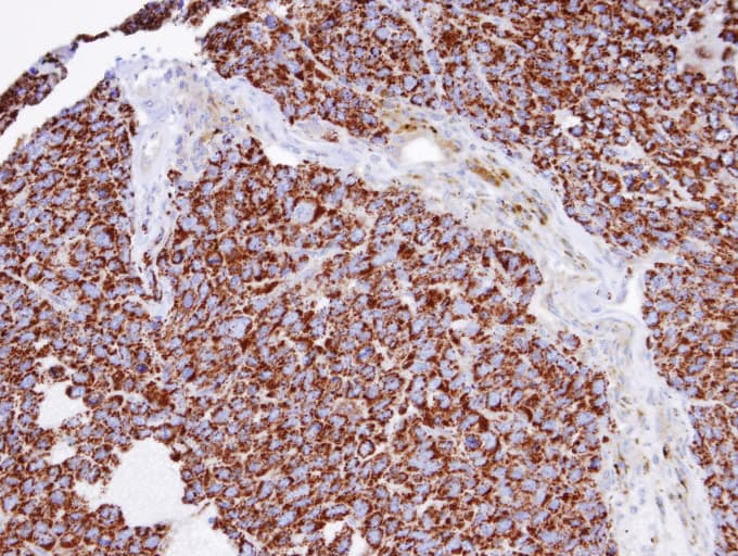 INPP1 Antibody (aa3-269)