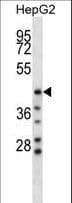 HYAL1 Antibody (aa280-309)