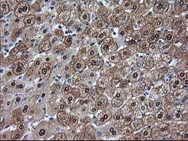 ADH2 / ADH1B Antibody (clone OTI1H7)